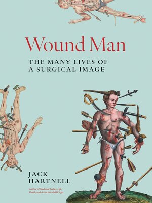 cover image of Wound Man